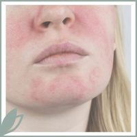 Higiene facial Capyl