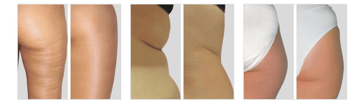 Captura de pantalla 2019-11-03 a las 2.03.44