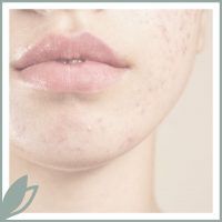 Higiene Pure Skin Cleanse